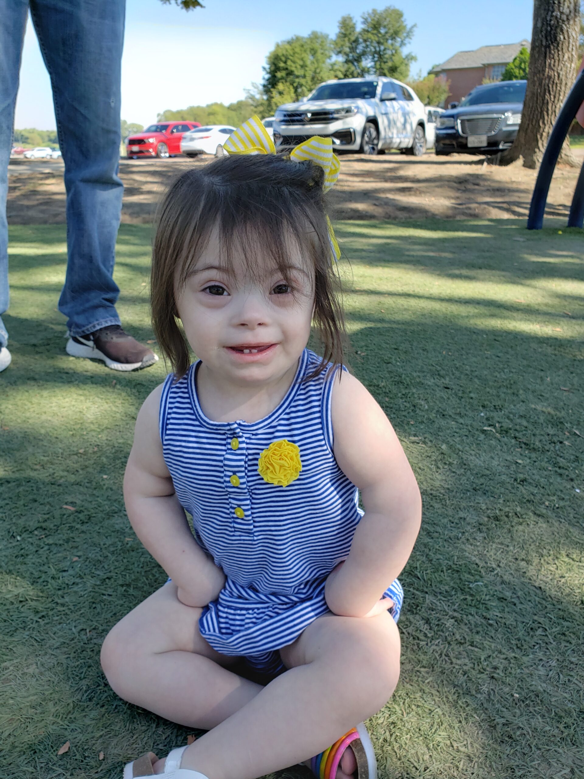 Toddler with Down syndrome